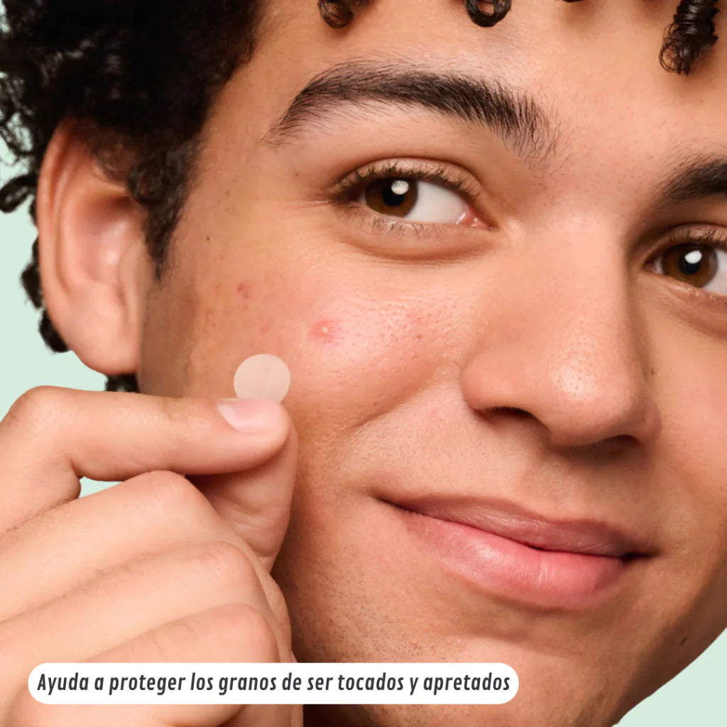 LumiPatch® — Parche Antiacné Invisible