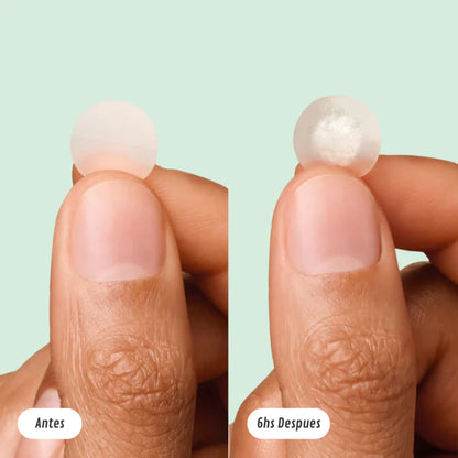 LumiPatch® — Parche Antiacné Invisible