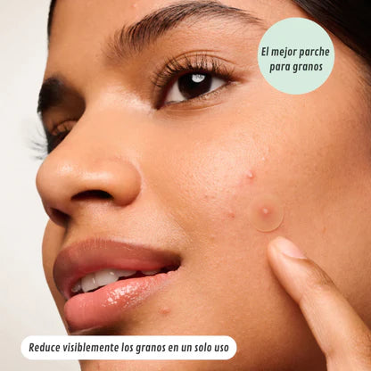 LumiPatch® — Parche Antiacné Invisible